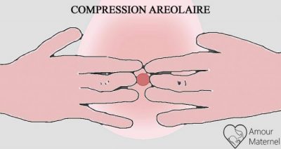engorgement mammaire méthode de compression aréolaire