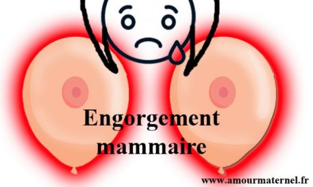 engorgement mammaire allaitement