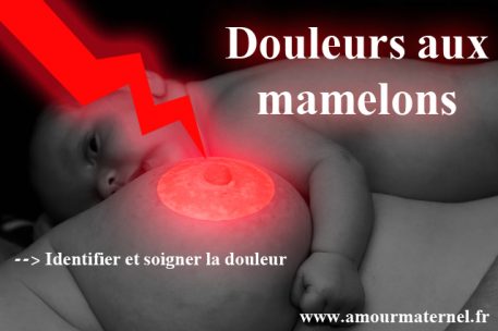 ▷ Douleur au téton : Causes et solutions au cas par cas.