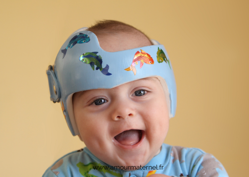 bebe tete plate casque